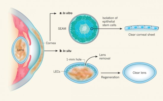 LECs in lens