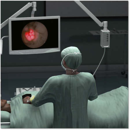 cerenkov-luminescence-imaging-breast-cancer-surgery
